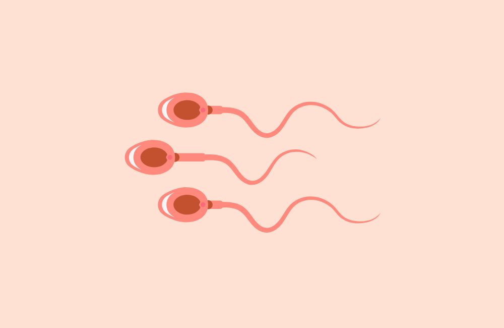 Spermiogramm: Ablauf, Auswertung, Diagnose & Kosten