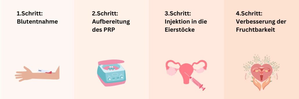 Eierstockverjüngung mit PRP