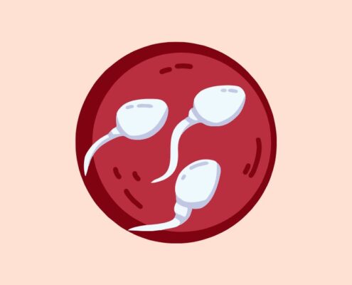 Asthenozoospermien