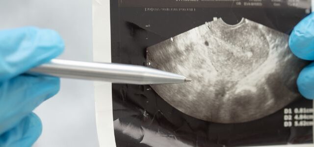 Kiw­uFin­der-Titel-Basic