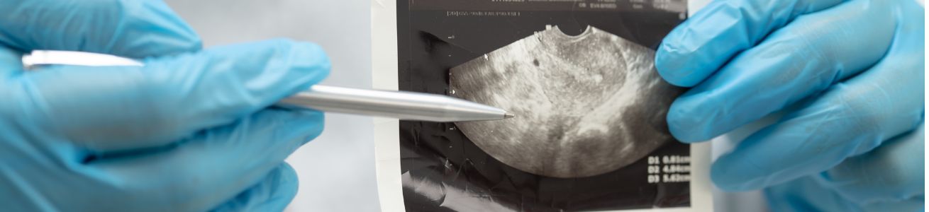 Kiw­uFin­der-Titel-Basic